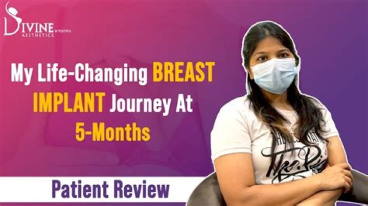 Unveiling Arielle Charnas' Breast Implant Journey: Discoveries And Insights